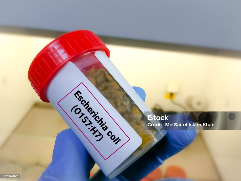 Stool Sample For E Coli O157h7 Test Serotype Of Escherichia Coli Stool Sample For E Coli O157h7 Test Serotype Of Escherichia Coli