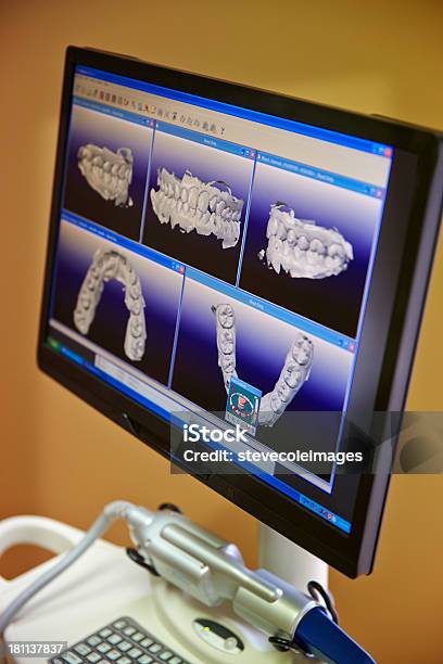 Стоматологическая Впечатления — стоковые фотографии и другие картинки Здоровье зубов - Здоровье зубов, Компьютерный монитор, Лаборатория