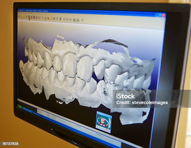 Dental Impression - Fotografie stock e altre immagini di Apparecchiatura odontoiatrica - Apparecchiatura odontoiatrica, Igiene dentale, Laboratorio