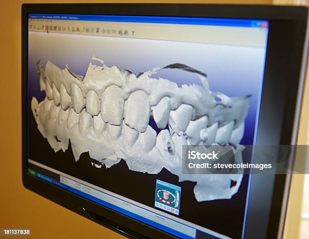 치아용 인상 치과 장비에 대한 스톡 사진 및 기타 이미지 - 치과 장비, 치아 건강, 실험실