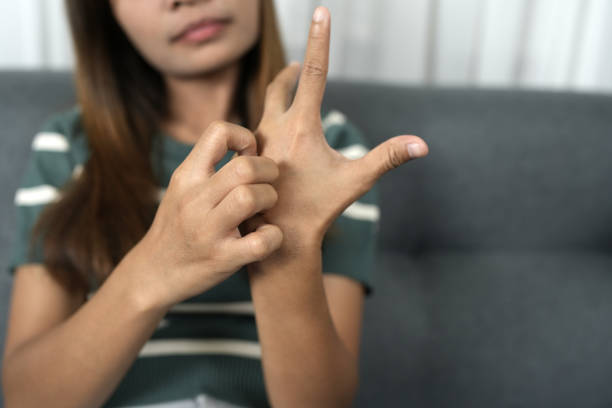 istock Asian woman has itchy skin on her hands 1812259290