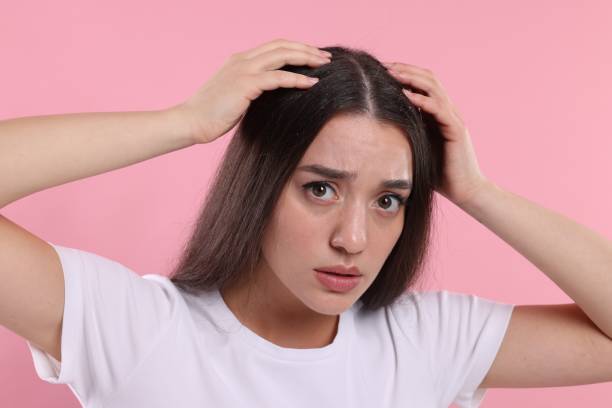 istock Emotional woman suffering from dandruff problem on pink background 1813698228