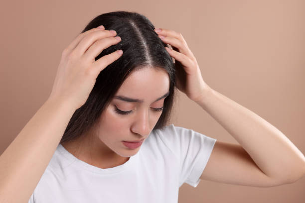 istock Woman suffering from dandruff problem on beige background 1813699828