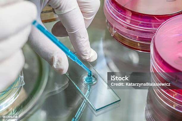 Pipette Und Fahren Stockfoto und mehr Bilder von Legionella pneumophila - Legionella pneumophila, Tuberkulose, Bakterie