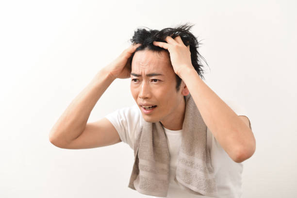 istock Asian man worrying about thinning hair while holding his head 1814888378