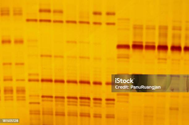 Dna 指紋 - 電気泳動実験のストックフォトや画像を多数ご用意 - 電気泳動実験, 電気泳動ゲル, DNA