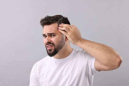 Emotional man with dandruff in his dark hair on light grey background