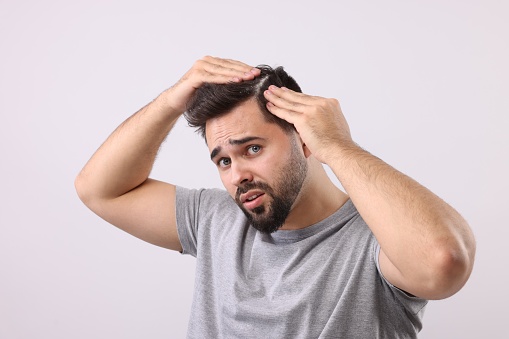 Emotional man with dandruff in his dark hair on light grey background