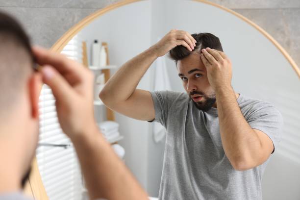 istock Emotional man examining his head near mirror in bathroom. Dandruff problem 1815471479