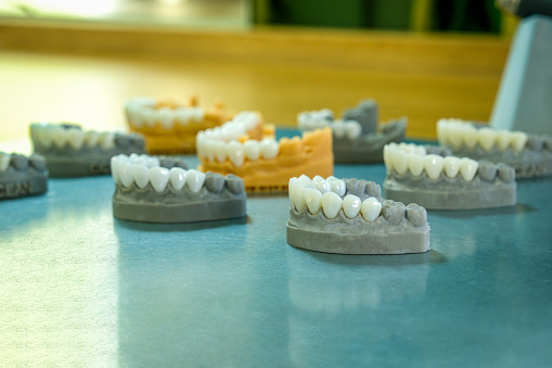 Sample crown teeth models