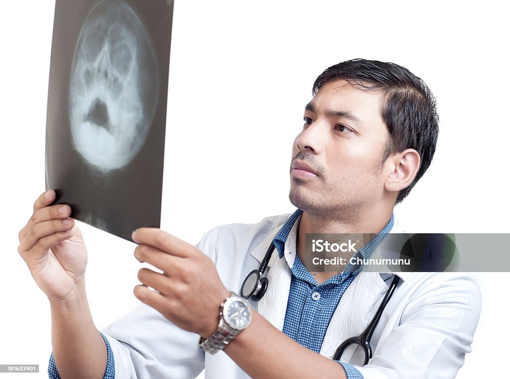 Молодой врач, глядя на рентгенографии органов грудной клетки. - Стоковые фото 20-29 лет роялти-фри