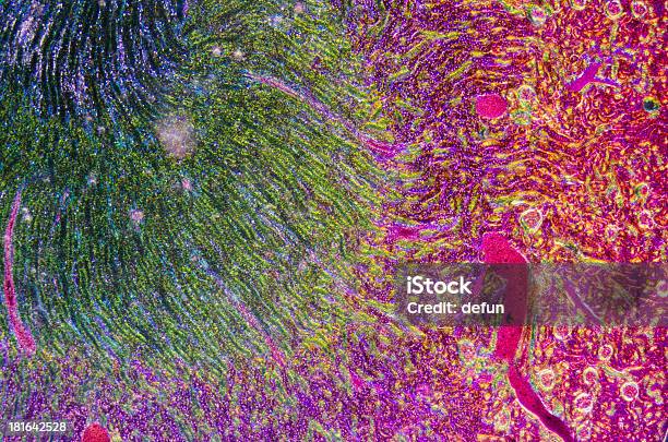 현미경 섹션 신장 조직 현미경에 대한 스톡 사진 및 기타 이미지 - 현미경, 세포, 인간의 세포