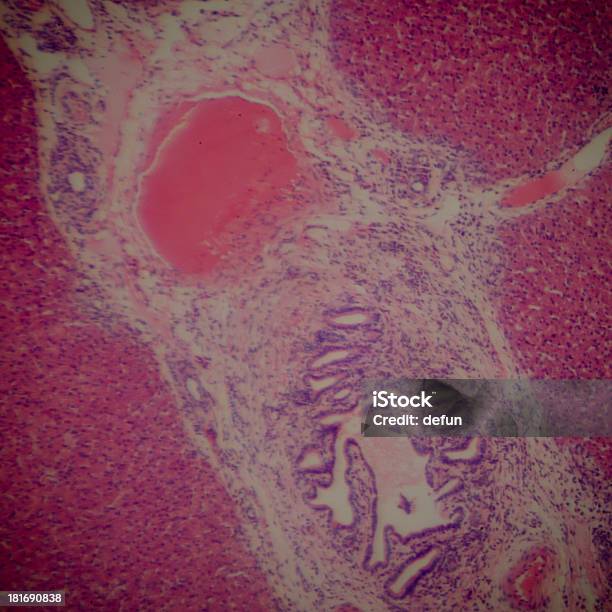 Mikroskopische Abschnitt Des Liver Stockfoto und mehr Bilder von Anatomie - Anatomie, Bildung, Biologie