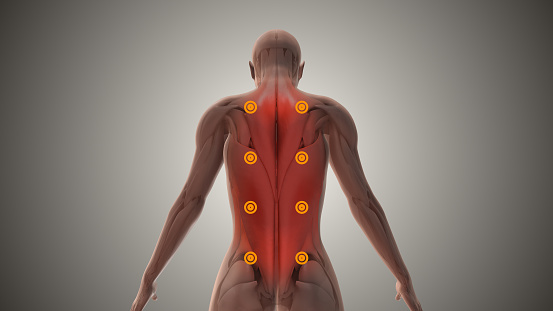 Myofascial pain syndrome is a disorder in which pressure on sensitive points in the muscles causes pain in seemingly unrelated body parts. The syndrome often happens after repeated injury or muscle overuse.
Symptoms include persistent pain or a tender muscle knot.
Treatments include physiotherapy, medication to relieve pain, local injections and relaxation techniques.