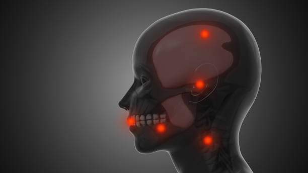istock Trigger points and myofascial pain in the TMJ 1816934718