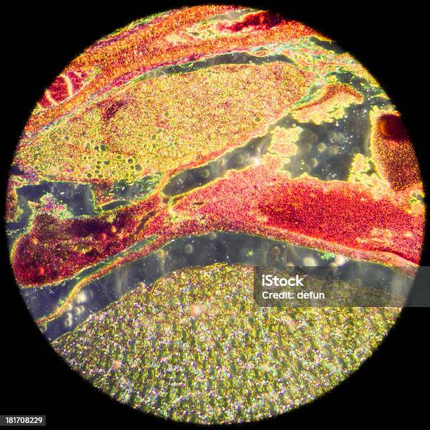 Microscópicos La Sección De Tejido Renal Foto de stock y más banco de imágenes de Corte transversal - Corte transversal, Portaobjetos de microscopio, Piel humana