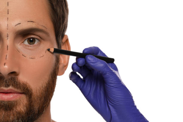 istock Doctor with pencil preparing patient for cosmetic surgery operation on white background, closeup 1817201798