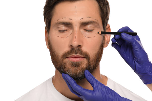 istock Doctor with pencil preparing patient for cosmetic surgery operation on white background, closeup 1817203466