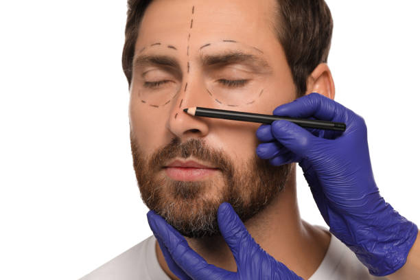 istock Doctor with pencil preparing patient for cosmetic surgery operation on white background, closeup 1817203959