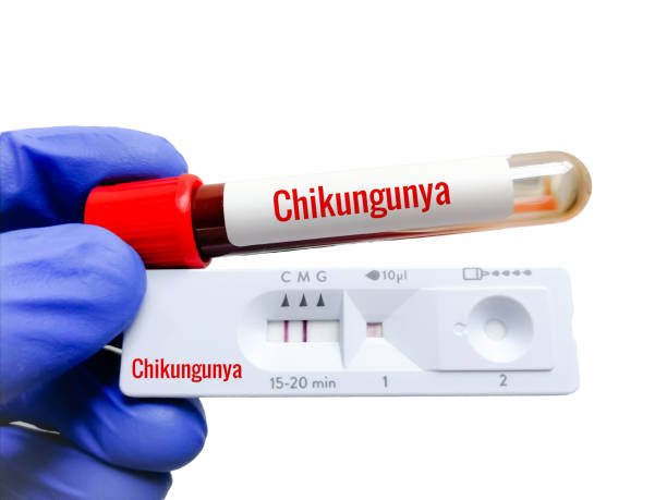 techniker hält blutprobe und schnelltestkassette mit chikungunya-positivem igm-ergebnis. - stem cell human cell animal cell science stock-fotos und bilder