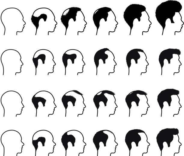 illustrazioni stock, clip art, cartoni animati e icone di tendenza di profilo di viso uomo calvizie processo & icone di bianco e nero - sideburn