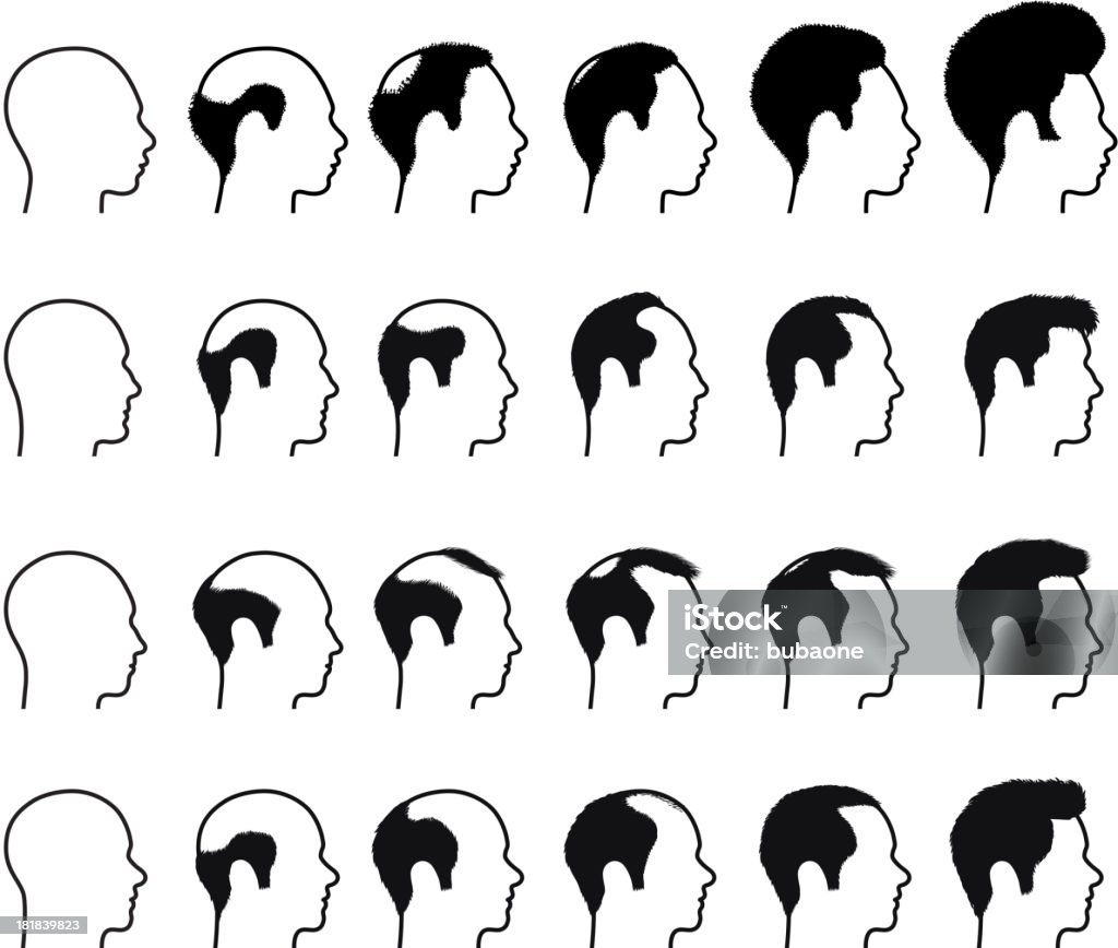 Perfil de Calvície processo Homem enfrenta & ícones preto branco - Royalty-free Calvície arte vetorial