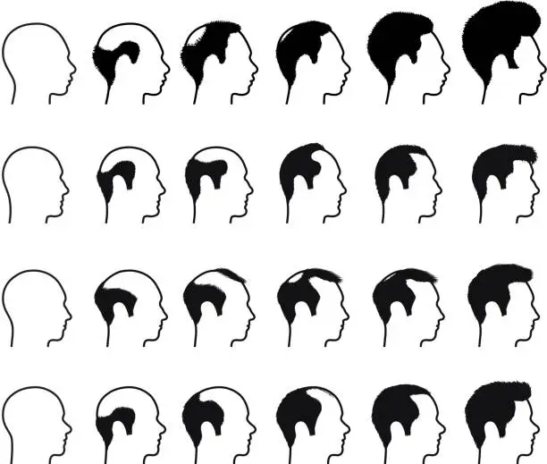 Vector illustration of Profile of Balding Process man Faces black & white icons
