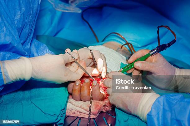 Mão De Cirurgia - Fotografias de stock e mais imagens de Aberto - Aberto, Abrir, Afiado