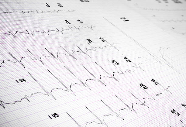istock Heart rate on medical print out 181862361