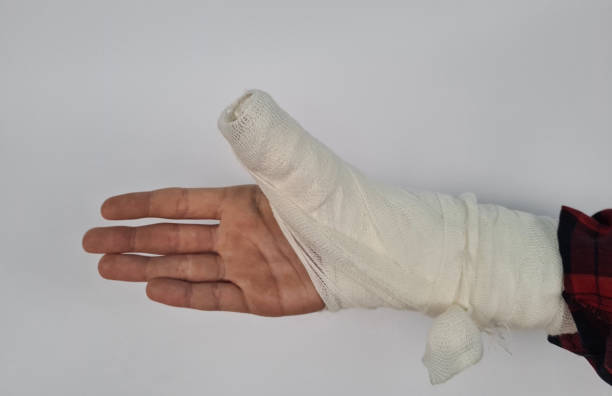 gros plan d’un enfant au bras cassé dans le plâtre - physical injury bandage wound cast photos et images de collection