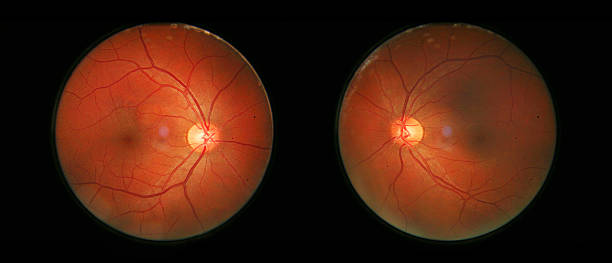 istock Human Eye Retina Photos 181868176