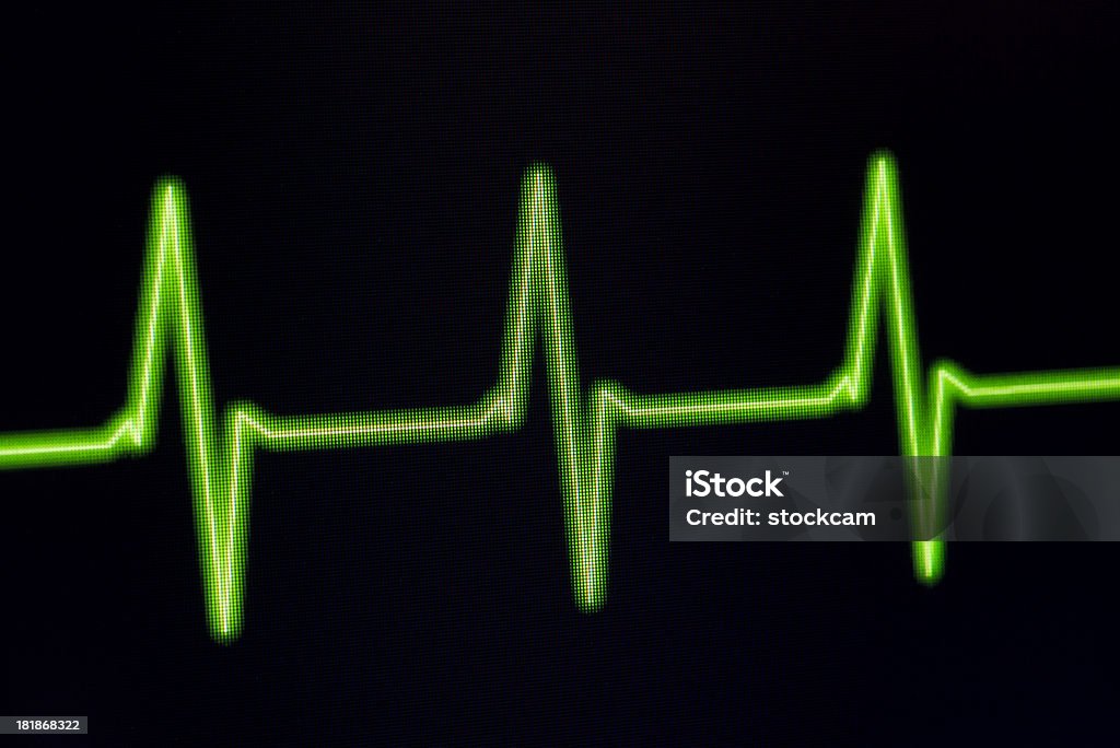 Moniteur ECG Electrocardiogram sur - Photo de Affichage digital libre de droits