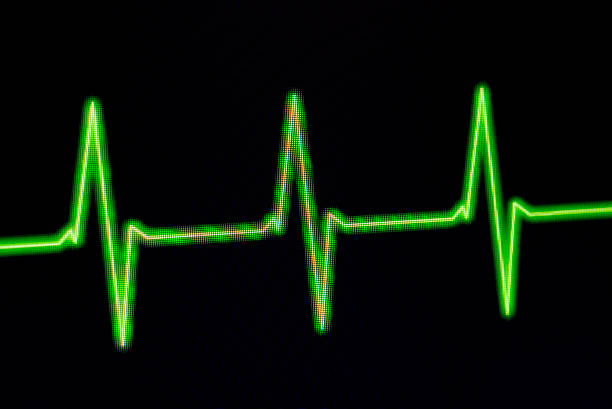 istock ECG Electrocardiogram on monitor 181868322