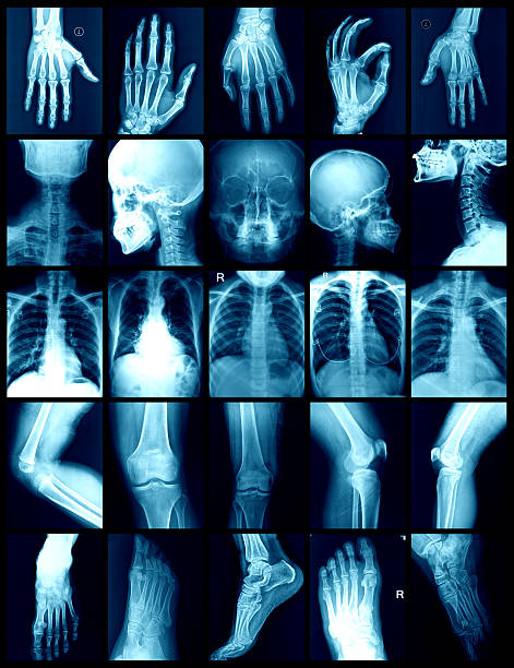 x-ray - bending human foot ankle x ray image - fotografias e filmes do acervo