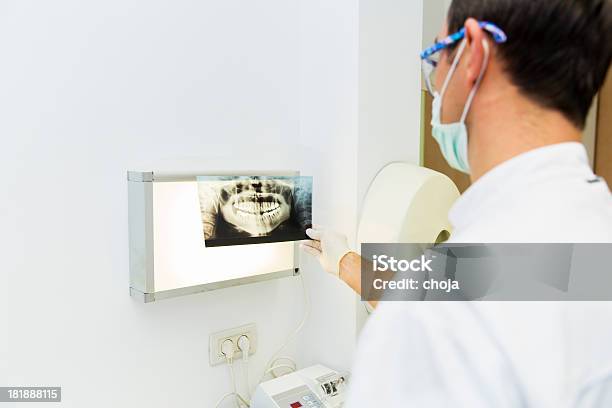 Zahnarzt Prüft Xray Der Zahn Stockfoto und mehr Bilder von Daten - Daten, Fotografie, Gesundheitswesen und Medizin