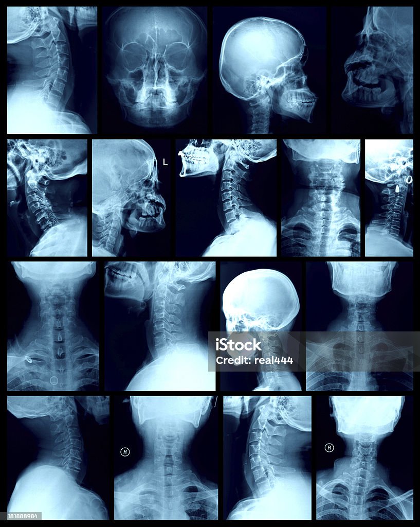 Cabeça Imagem de raios X - Royalty-free Anatomia Foto de stock