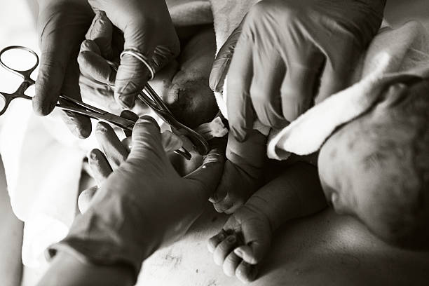 cutting baby's umbilical cordon Doctor doing an operation home birth photos stock pictures, royalty-free photos & images