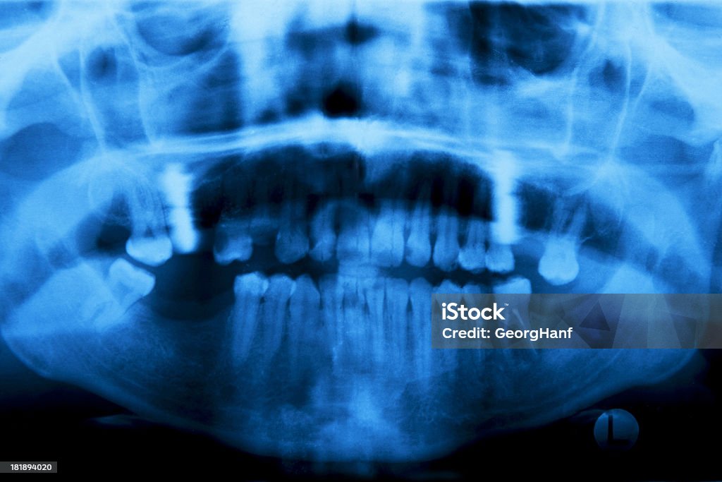 panorama dentale - Foto stock royalty-free di Anatomia umana