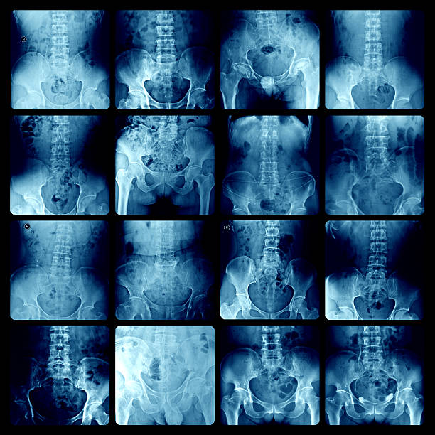 腰椎 vertebrae x 線 - pain rib cage x ray image chest ストックフォトと画像