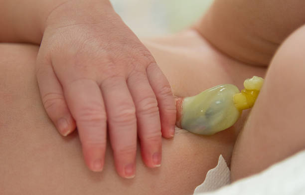 istock an umbilical cord in a newborn baby's belly 181934875