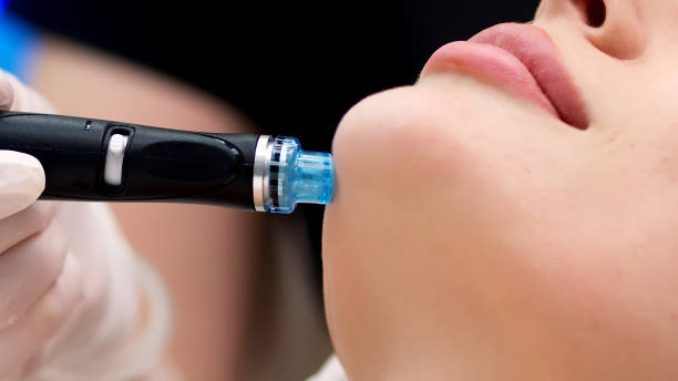 istock Professional dermatologist in medical gloves doing hydro peeling procedure for beautiful woman patient in cosmetology clinic. Close up facial treatment. 1820030166
