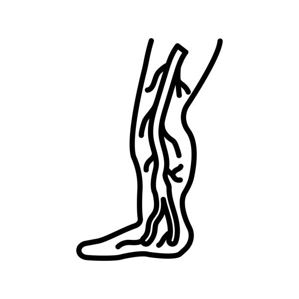 40+ Tibial Vein Stock Illustrations, Royalty-Free Vector Graphics ...