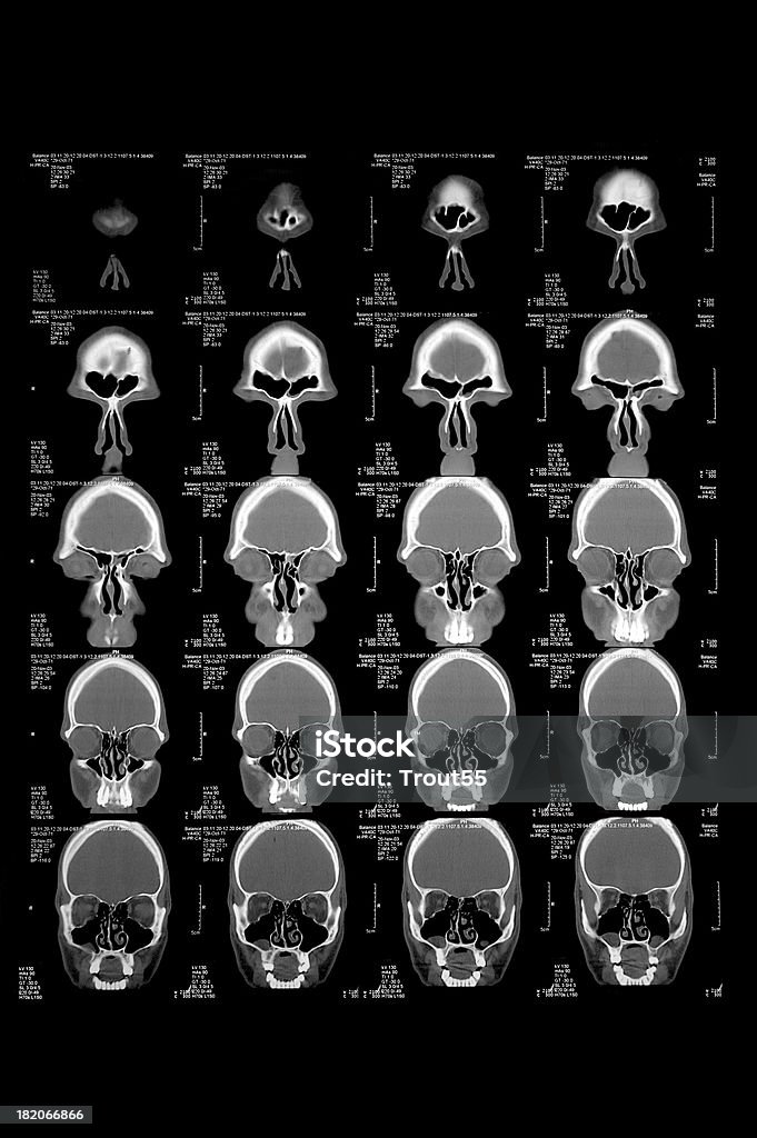 Головы и головного мозга в карата - Стоковые фото Machinery роялти-фри
