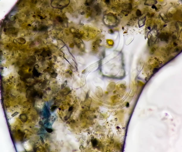 istock Schistosoma Haematobium Parasite  in human urine specimen under microscope. Urinary parasite 1820798320