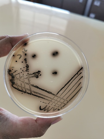 Quadrant streak of a bacteria species growing on a Baird-Parker agar plate.