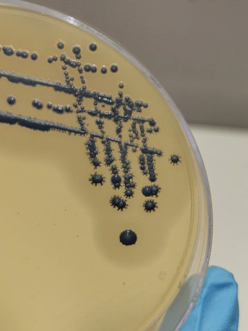A quadrant streak of the bacterium Staphylococcus aureus cultured or inoculated on Baird-Parker agar with egg tellurite .