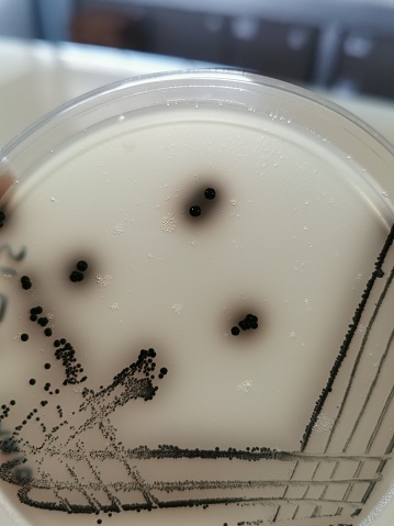 Quadrant streak of a bacteria species growing on a Baird-Parker agar plate.