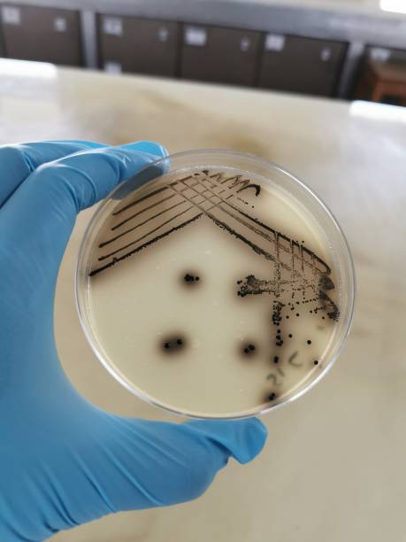 Bacteria Species Growing on a Baird-Parker Agar Plate Quadrant streak of a bacteria species growing on a Baird-Parker agar plate. staphylococcal enterotoxicosis stock pictures, royalty-free photos & images