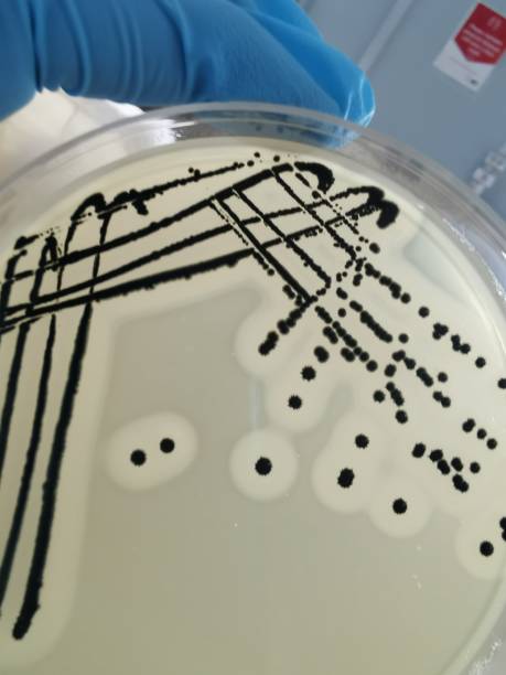 Staphylococcus aureus on Baird-Parker Agar A quadrant streak of the bacterium Staphylococcus aureus cultured or inoculated on Baird-Parker agar with egg tellurite . staphylococcal enterotoxicosis stock pictures, royalty-free photos & images