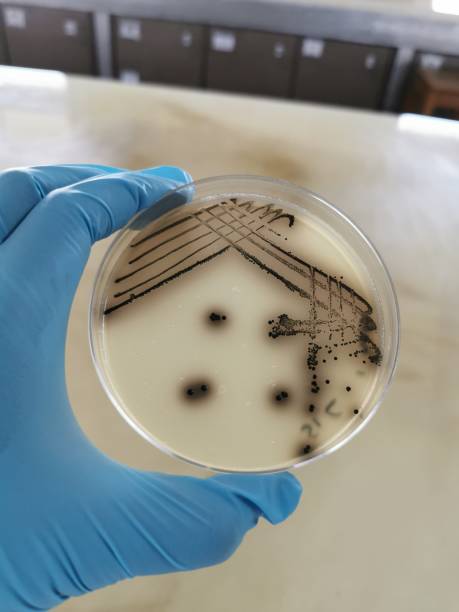 Bacteria Species Growing on a Baird-Parker Agar Plate Quadrant streak of a bacteria species growing on a Baird-Parker agar plate. staphylococcal enterotoxicosis stock pictures, royalty-free photos & images